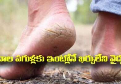 Cracked heels:పాదాల పగుళ్లకు ఇంట్లోనే ఖర్చులేని వైద్యం..ఇలా చేస్తే చాలు