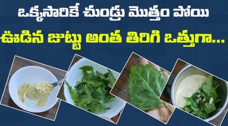 Dandruff:ఒక్కసారికే చుండ్రు మొత్తం పోయి ఊడిన జుట్టు అంత తిరిగి ఒత్తుగా పెరుగుతుంది