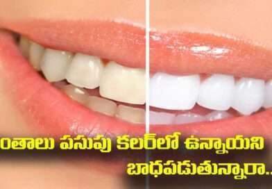 Teeth Remedies: దంతాలు పసుపు కలర్‌లో ఉన్నాయని బాధపడుతున్నారా..? ఇలా చేస్తే తెల్లగా మెరిసిపోతాయ్.