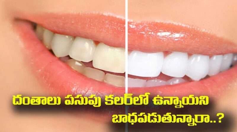 Teeth Remedies: దంతాలు పసుపు కలర్‌లో ఉన్నాయని బాధపడుతున్నారా..? ఇలా చేస్తే తెల్లగా మెరిసిపోతాయ్.